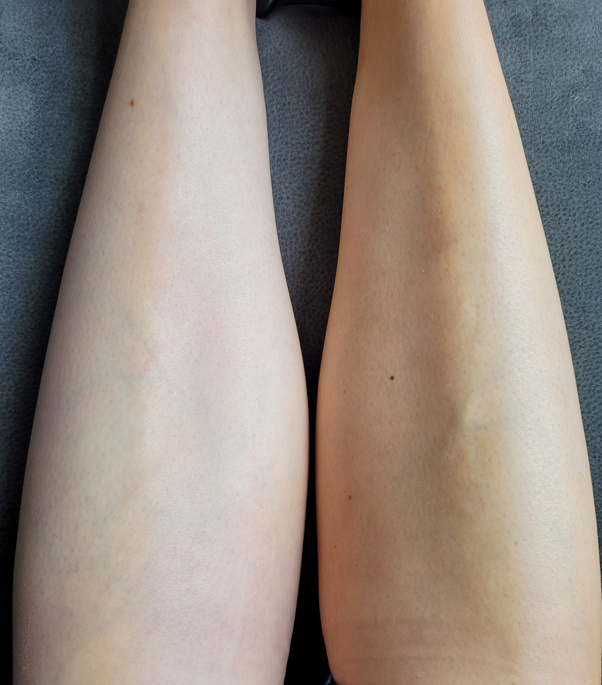photo - Lois Enthoven | Beauty & Massage