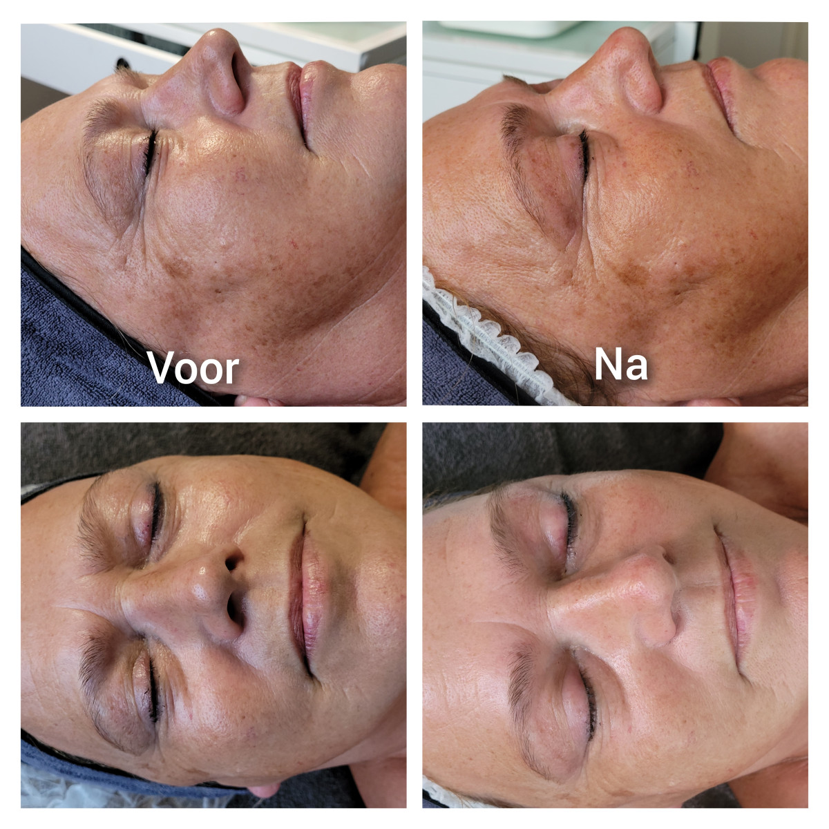 photo - Lois Enthoven | Beauty & Massage