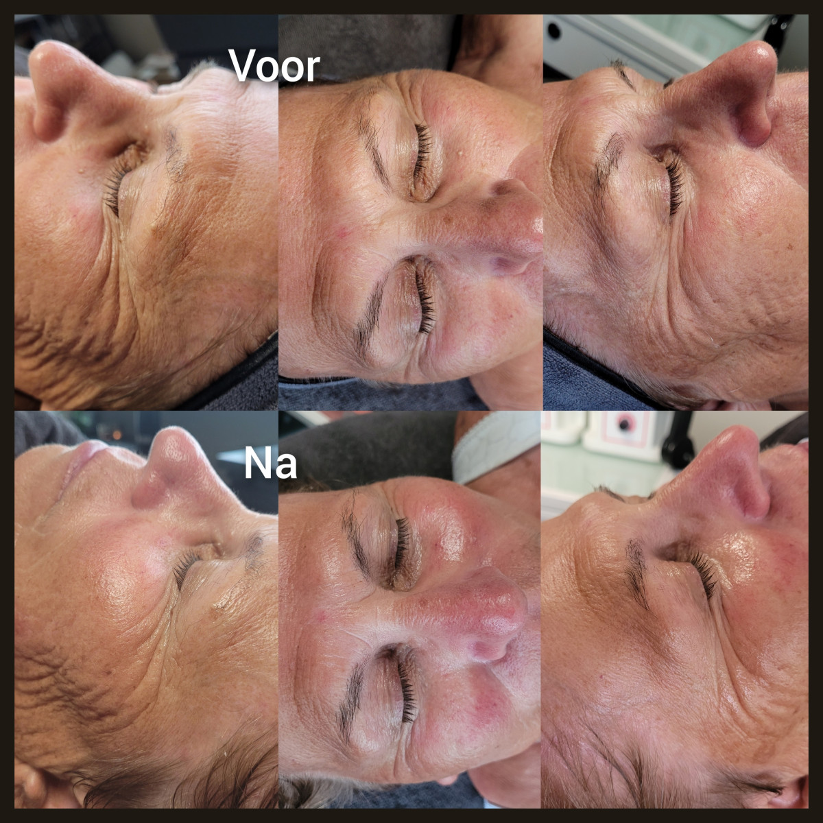 photo - Lois Enthoven | Beauty & Massage
