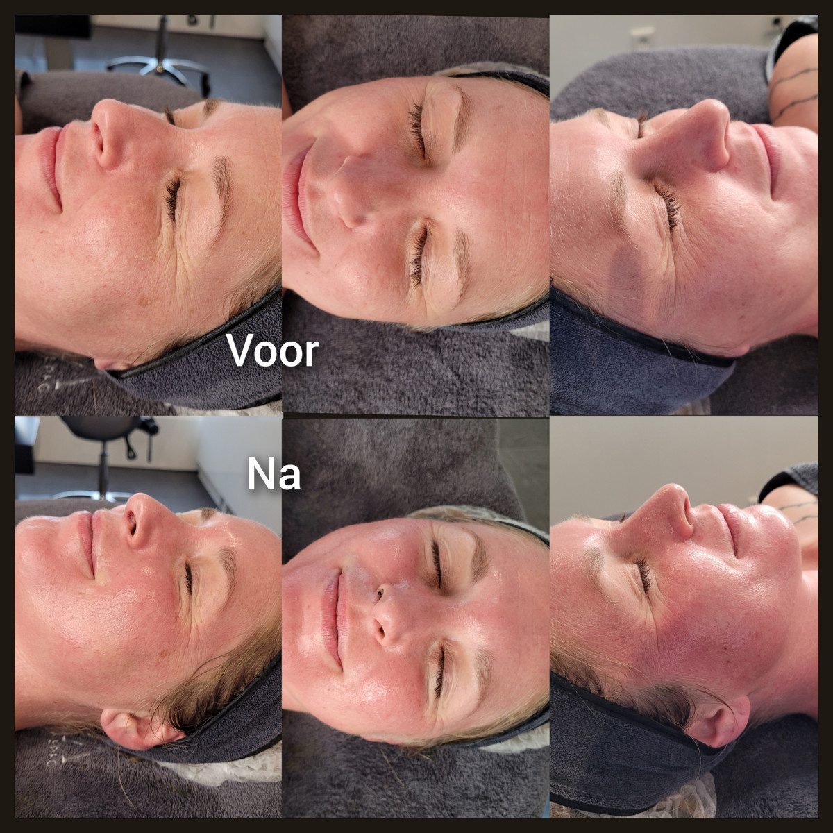 photo - Lois Enthoven | Beauty & Massage