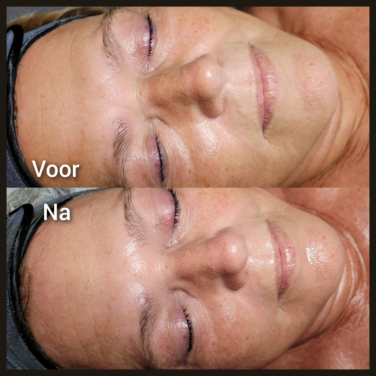 photo - Lois Enthoven | Beauty & Massage