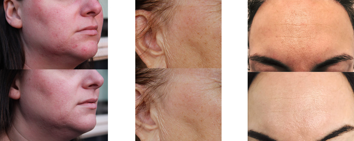 photo - Lois Enthoven | Beauty & Massage