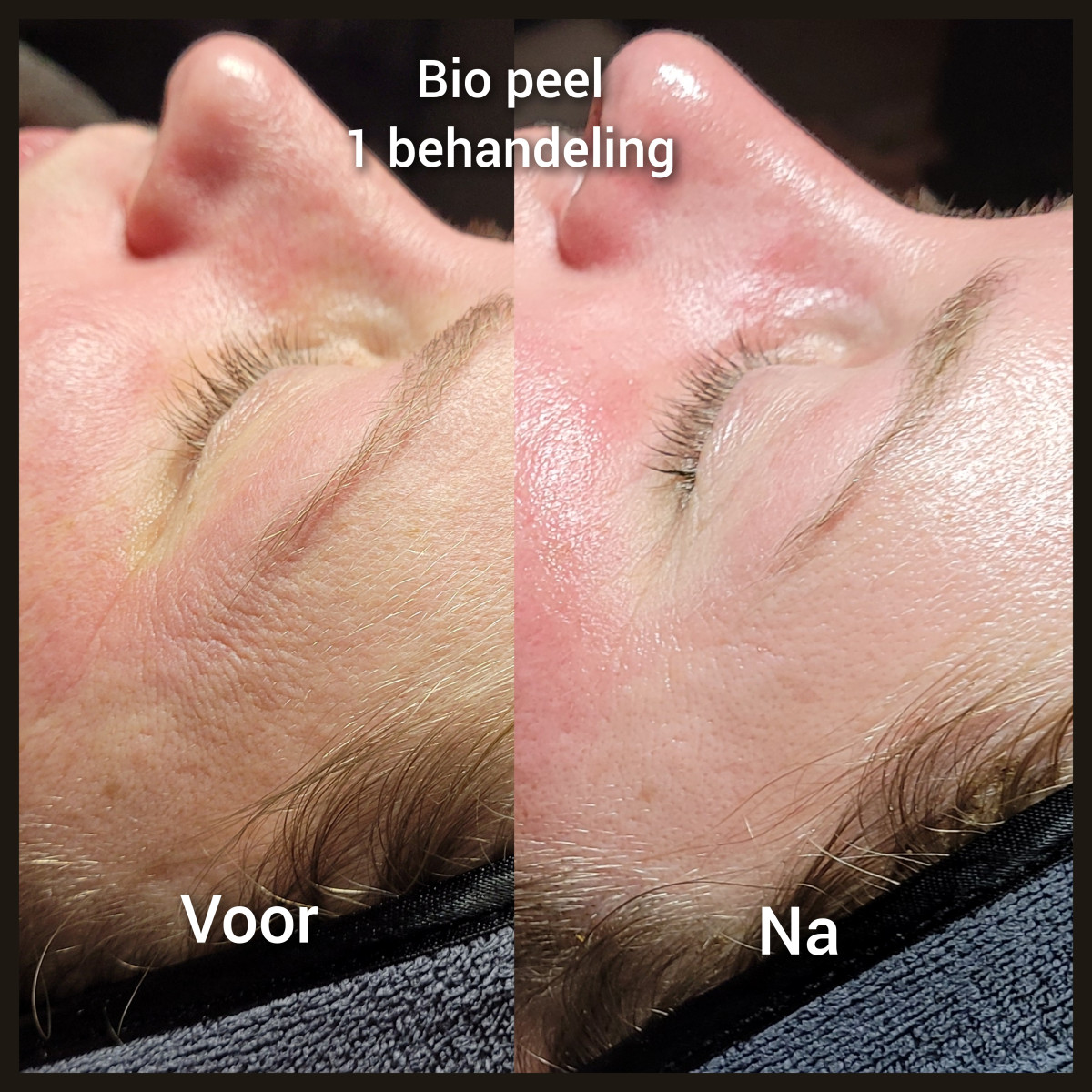photo - Lois Enthoven | Beauty & Massage