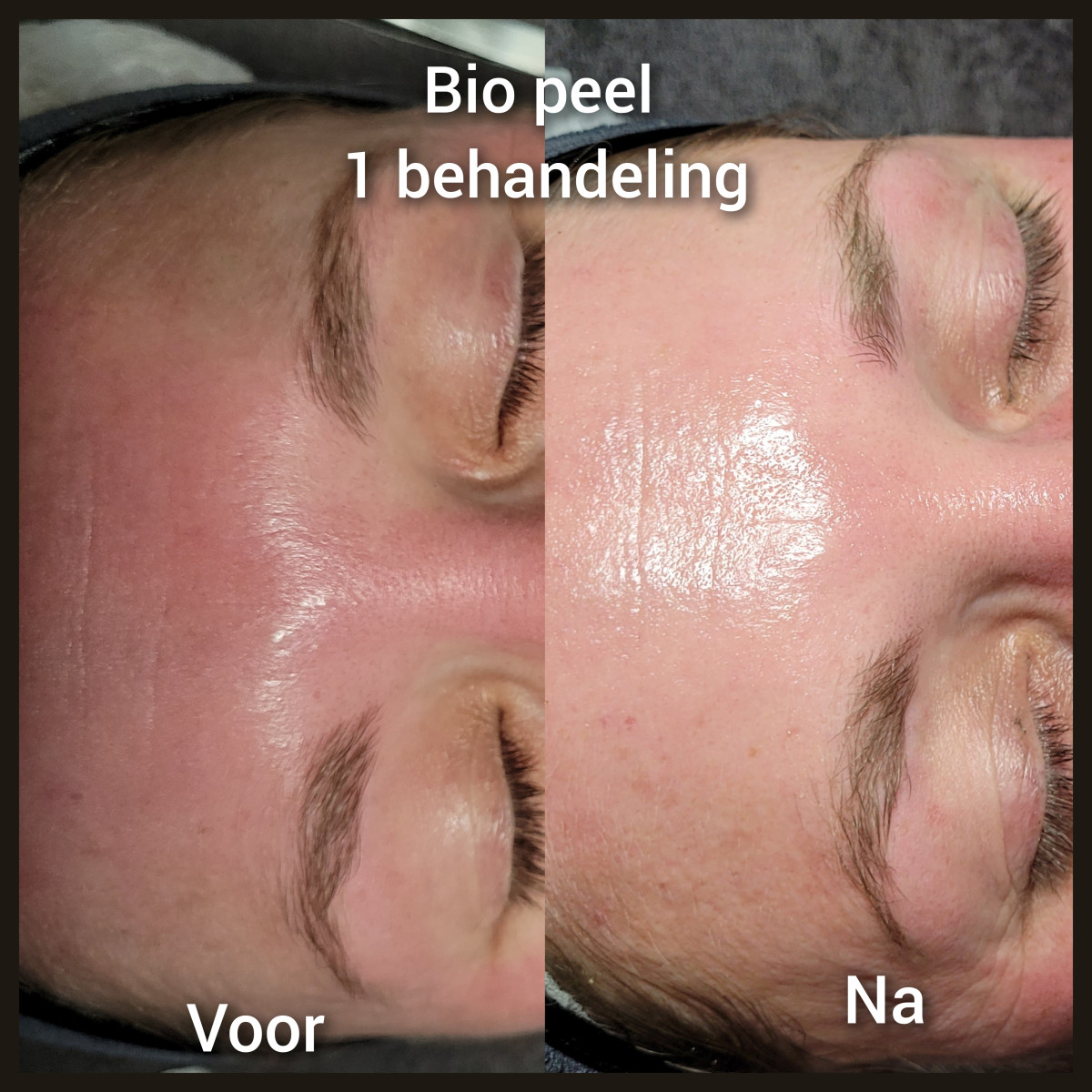 photo - Lois Enthoven | Beauty & Massage